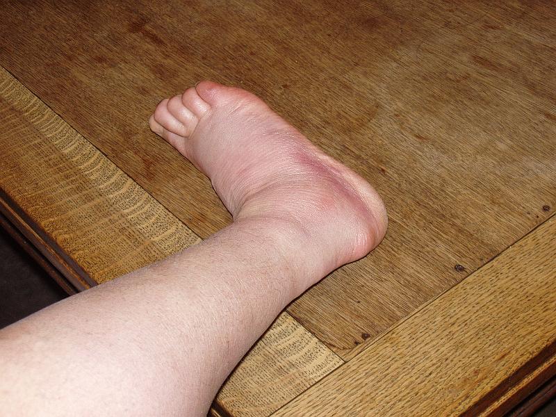 2 (10).JPG